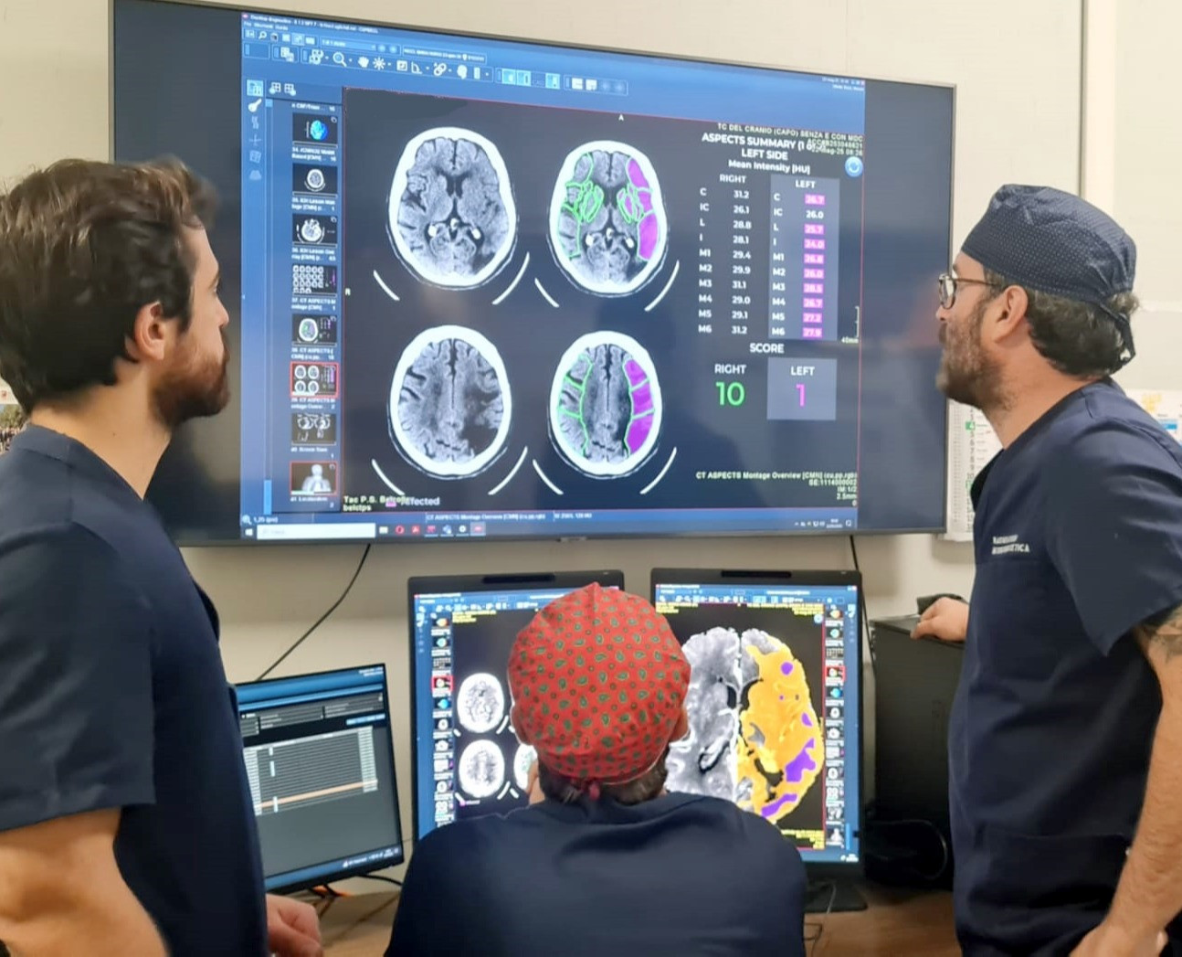 Al Santa Rosa un software basato sull’intelligenza artificiale consente una diagnosi rapida e precisa dell’ictus cerebrale